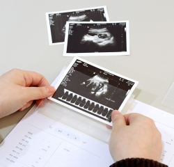 PREGNANCY DIARY